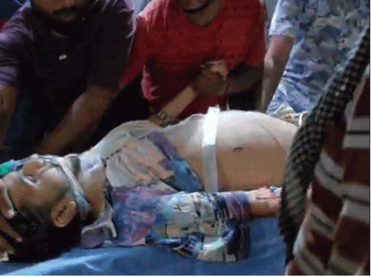 घायल सौरभ की हालत गंभीर है। वहीं सिमरन की मौत हो गई।
